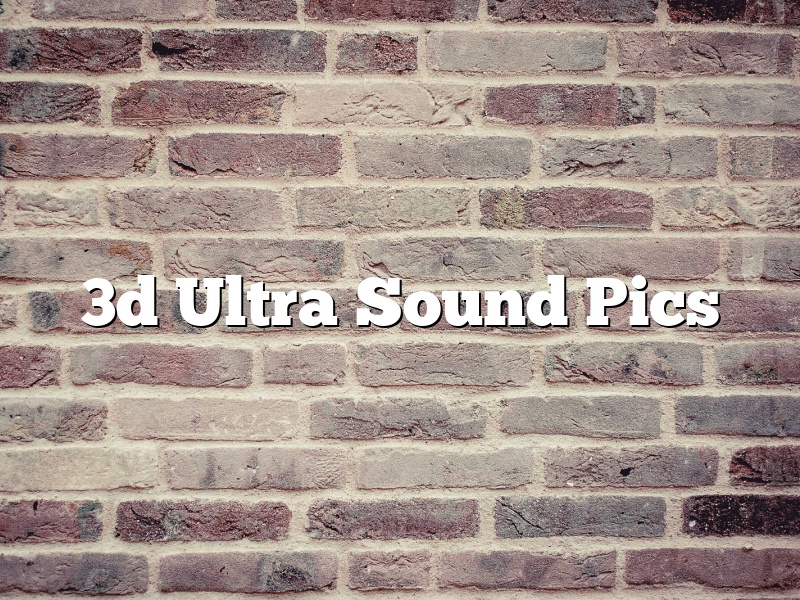 3d Ultra Sound Pics