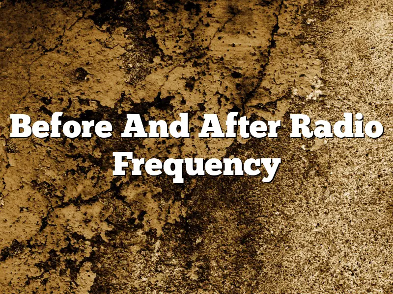 Before And After Radio Frequency
