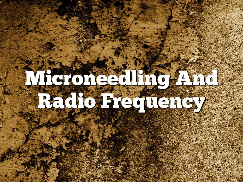 Microneedling And Radio Frequency