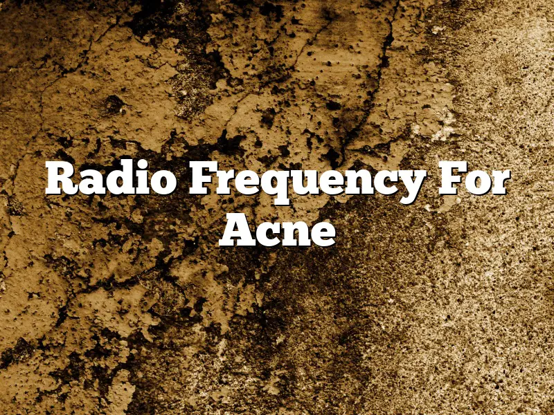 Radio Frequency For Acne