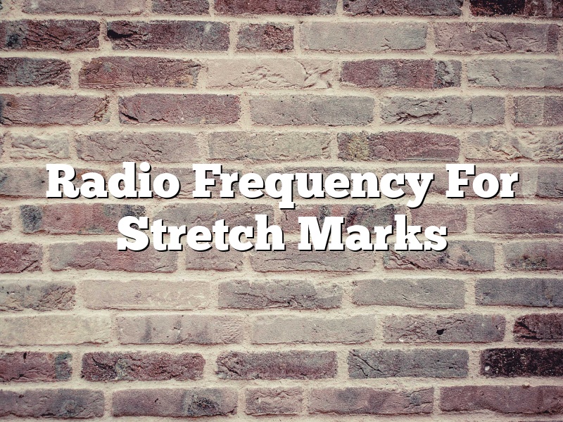 Radio Frequency For Stretch Marks
