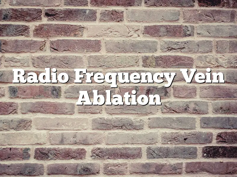 Radio Frequency Vein Ablation