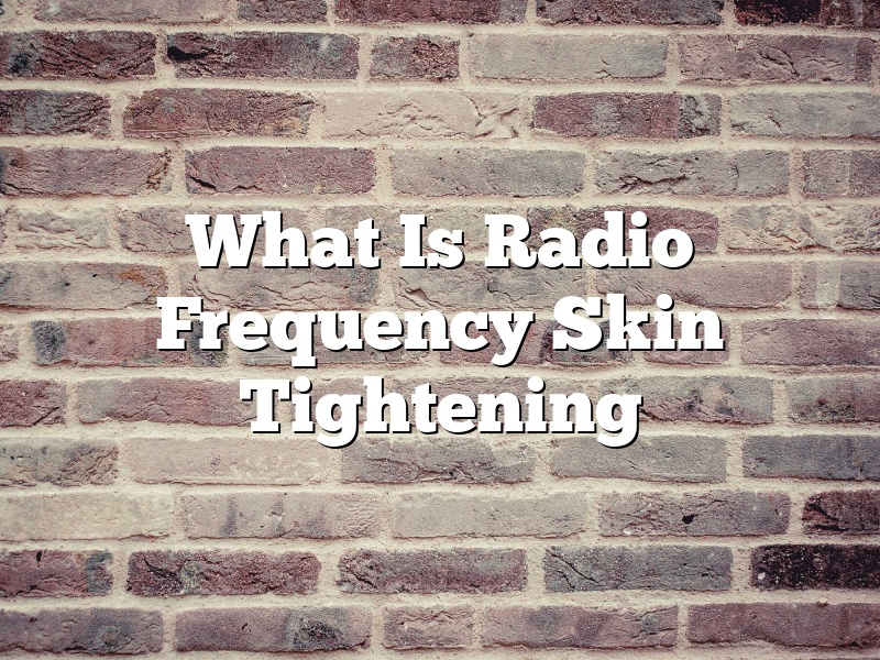 What Is Radio Frequency Skin Tightening