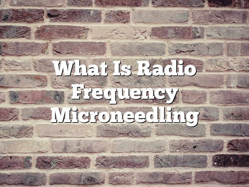 What Is Radio Frequency Microneedling